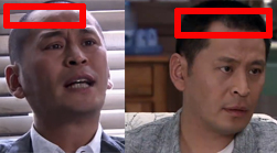 頭發(fā)逆天生長